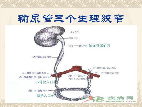 引起输尿管结石的原因及相关症状和预防